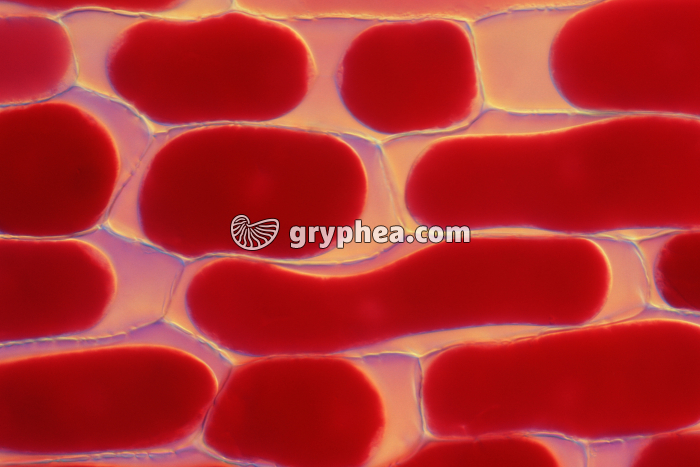 Cellules de l'épiderme d'oignon rouge - partiellement plasmolysées x100 - gryphea.org